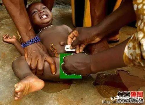 割包皮-割阴蒂-包皮环切-灭绝人性-图解揭秘非洲"割礼"恶俗 残酷习俗