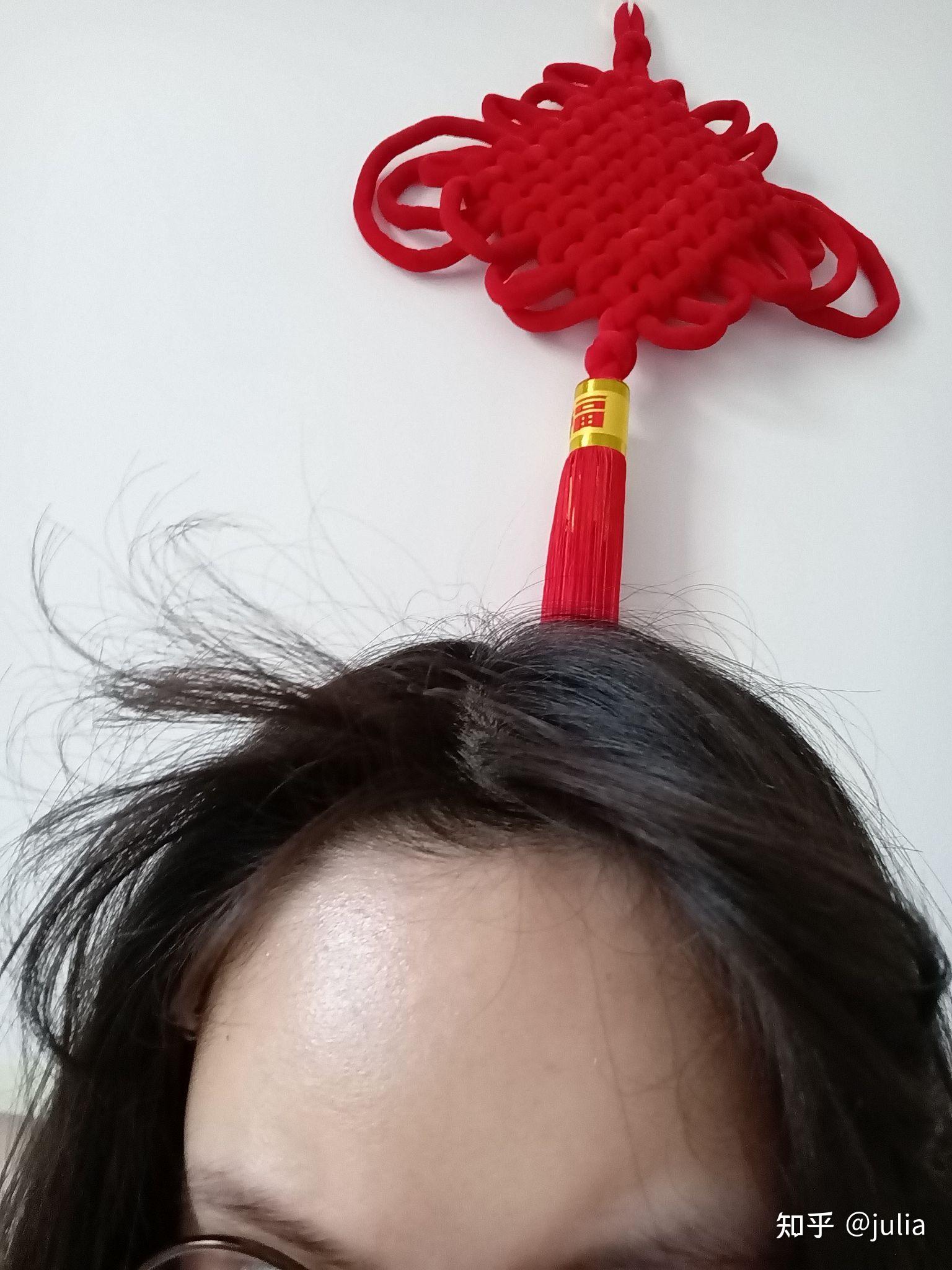 女生发际线处有个旋很难做发型有同胞么怎么破