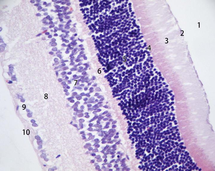 在宽广的眼球壁后部,脉络膜内面的深染薄层结构即为视网膜. 视网膜在