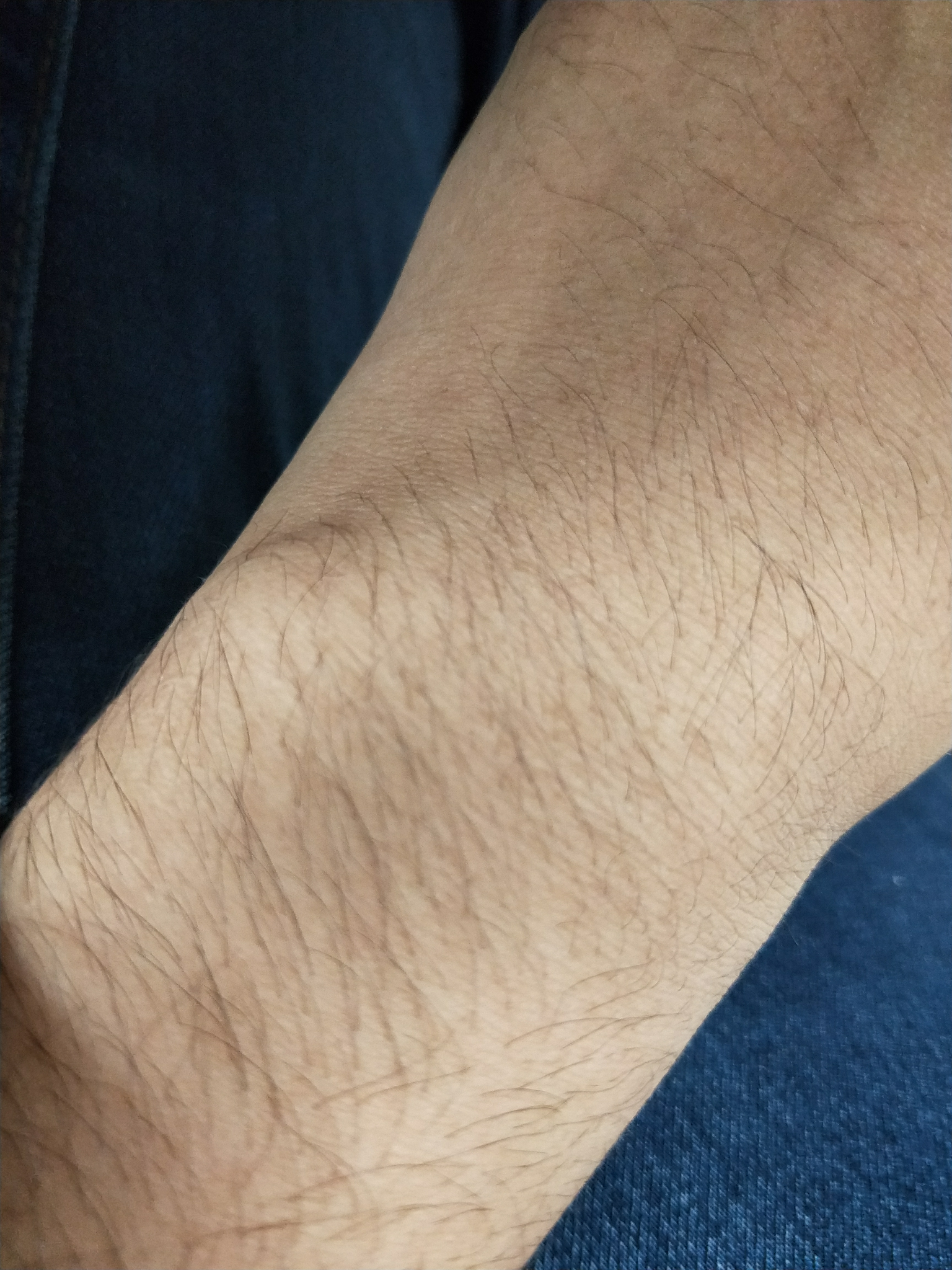 女生汗毛重是怎样的一种体验