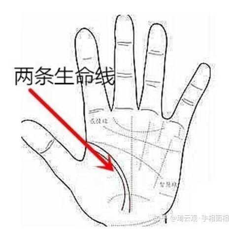 生命线旁边另有一条,这是两条生命线吗? - 知乎