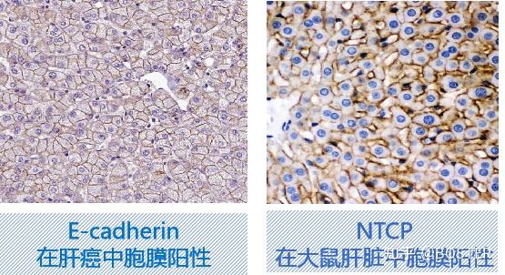 免疫组化(IHC)实验从入门要高阶一篇搞定 - 知乎