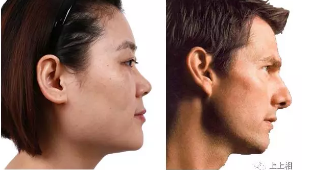 侧颜美不美全看这四点--正脸美，侧脸更要美 - 知乎