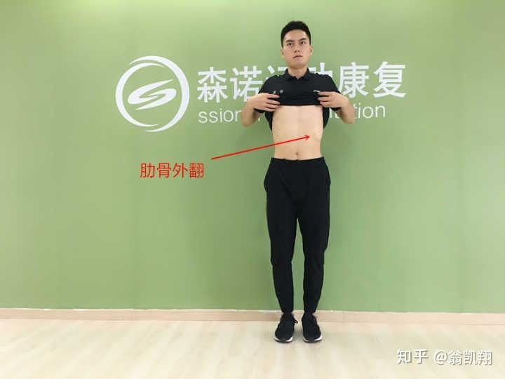 肋骨两边不一样高要不要去医院看看