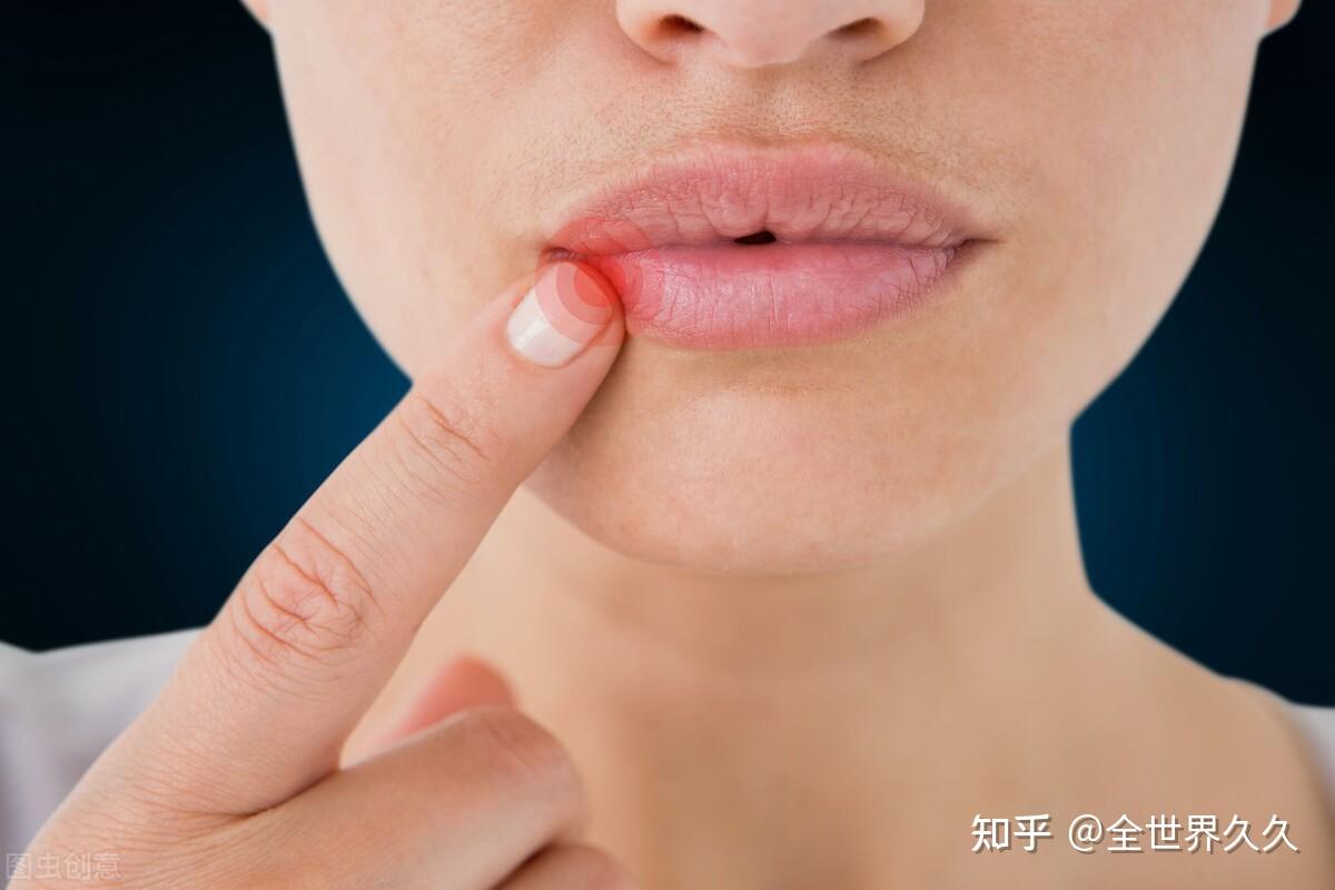秋季“长痘、口疮、流鼻血、皮肤干”怎么破？ - 知乎