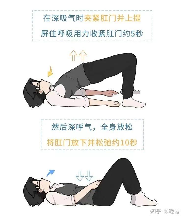 提肛运动操作 如忍住排便,将肛门收缩并向上提,再放松肛门括约肌片刻.