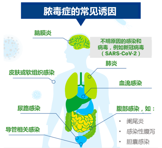 【对症创药】脓毒症——新冠ICU里的生命收割者 - 知乎