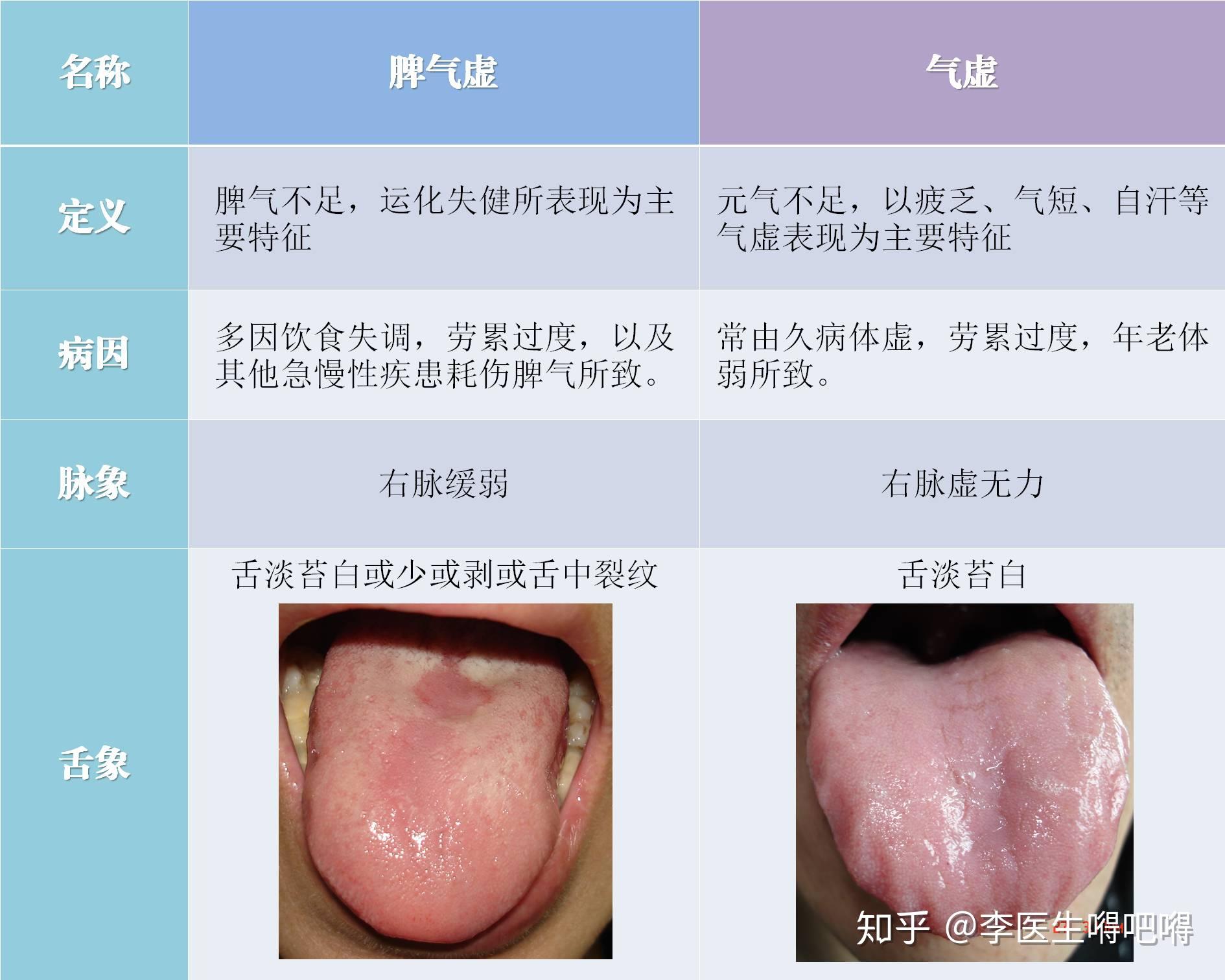 如何一起改善脾虚和气虚的体质? - 知乎