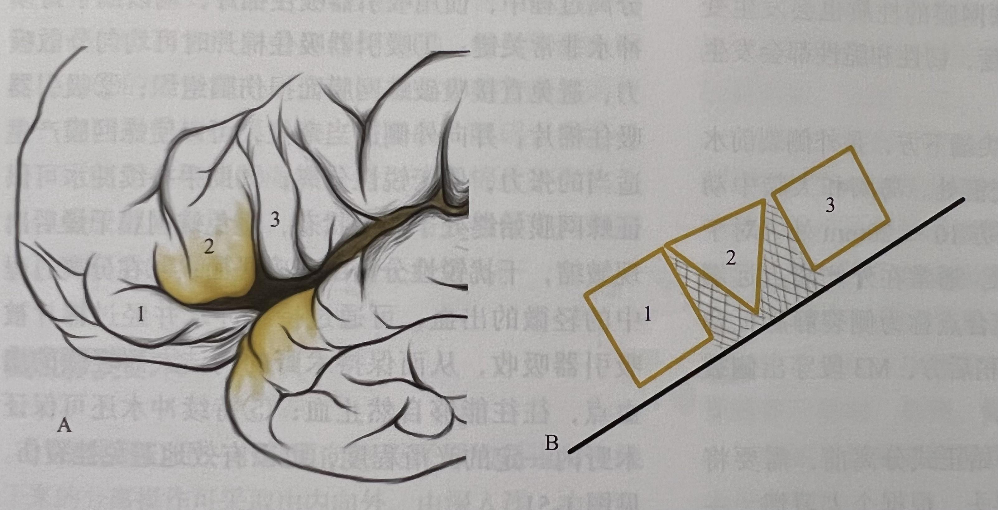 翼点入路——解剖学习 - 知乎