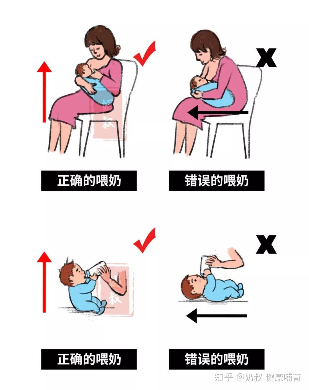 早產兒吐奶嗆奶頻繁什麼樣的餵奶姿勢有助於緩解