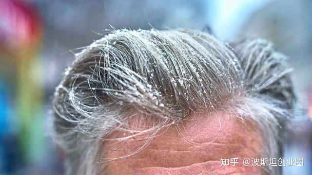 白发的类型!看看你属于哪一种? - 知乎