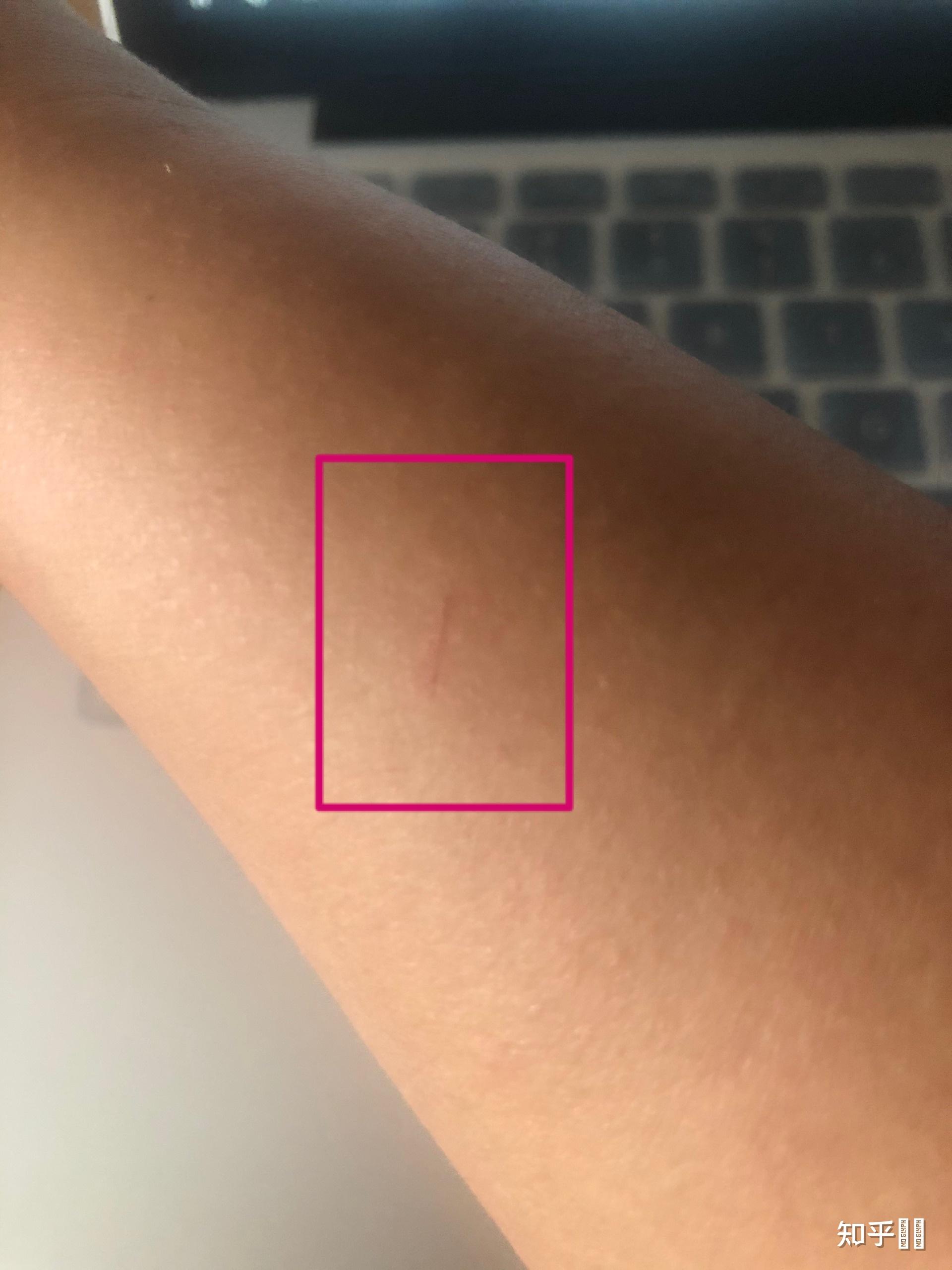 被狗狗抓子抓了会得狂犬病吗? - 知乎