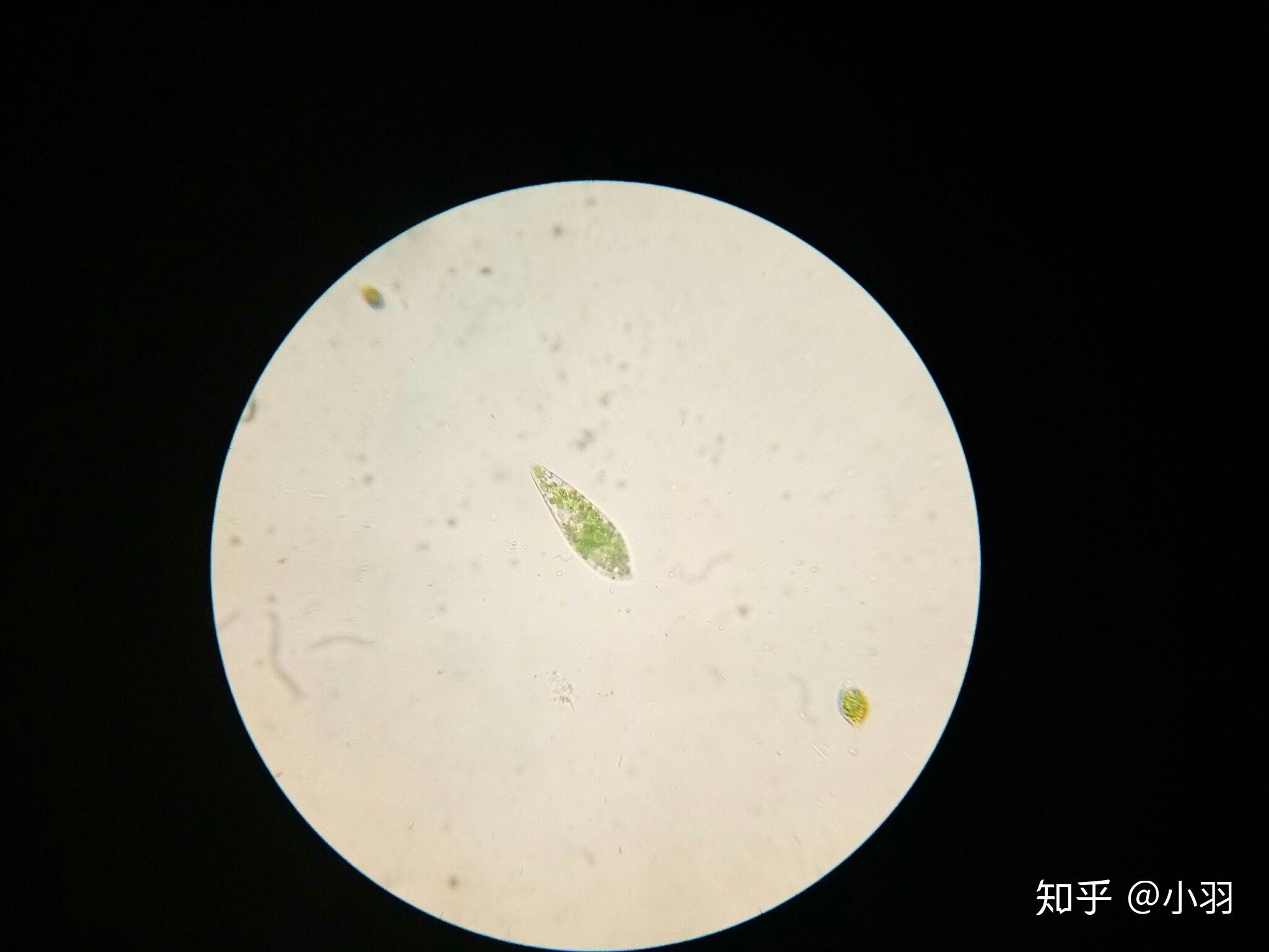 如何在野外找到天蓝喇叭虫stentorcoeruleus