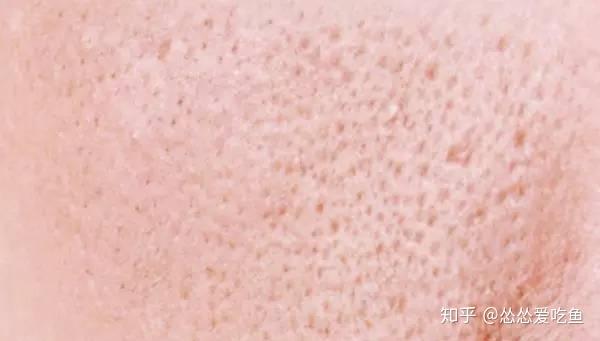 如何改善油皮? - 知乎