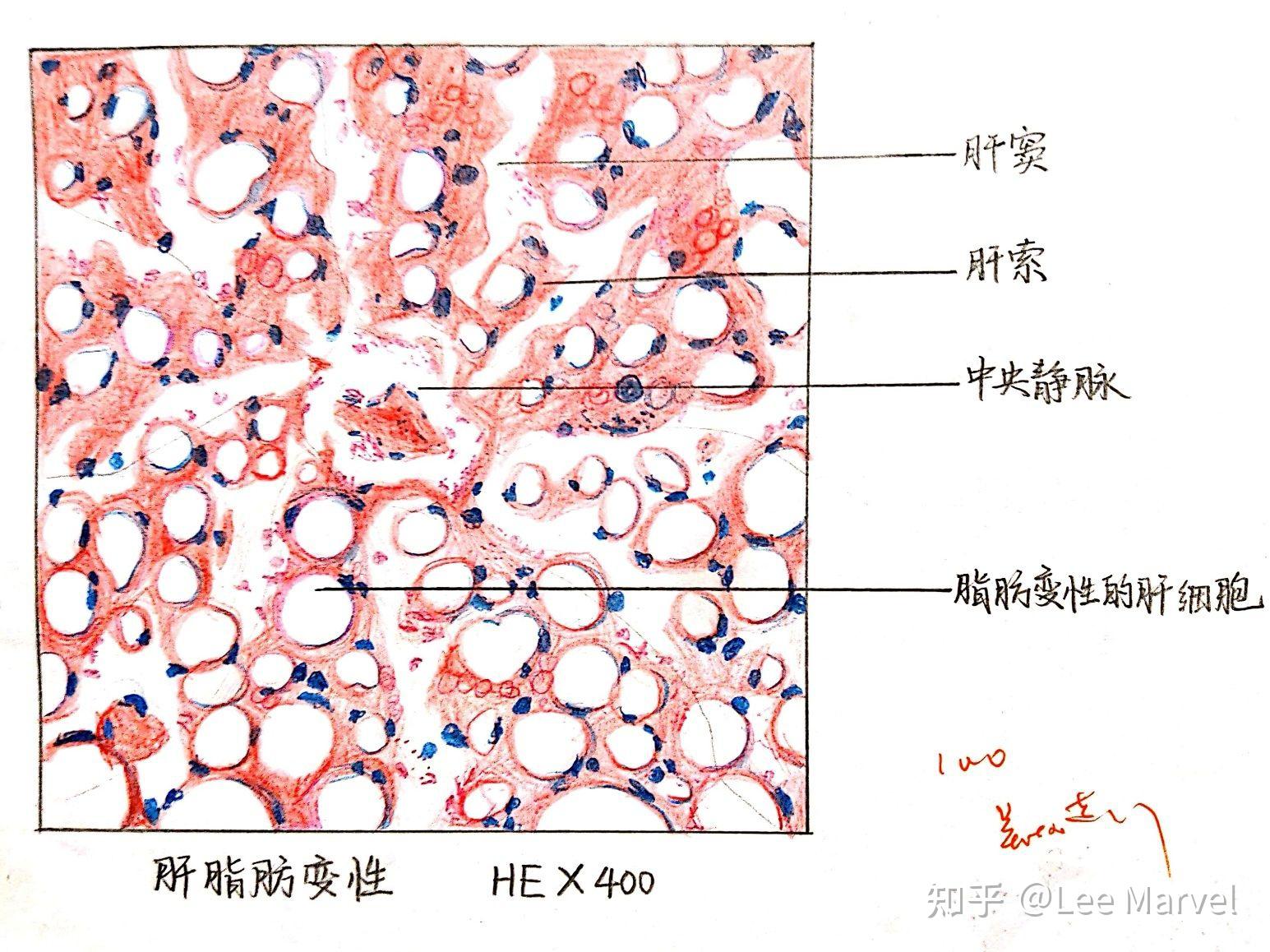 肝索怎么画图片