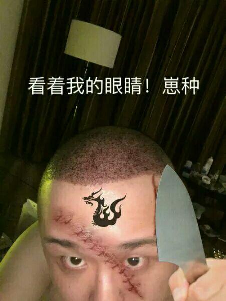 笑笑孙亚龙植发了不能调侃他大秃头了再