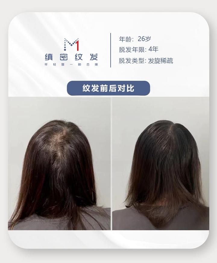 发缝加密,原来这么简单 - 知乎