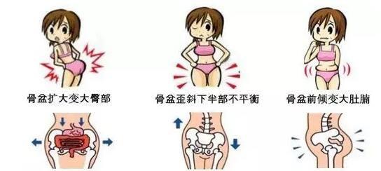 产后腹直肌分离是个什么鬼