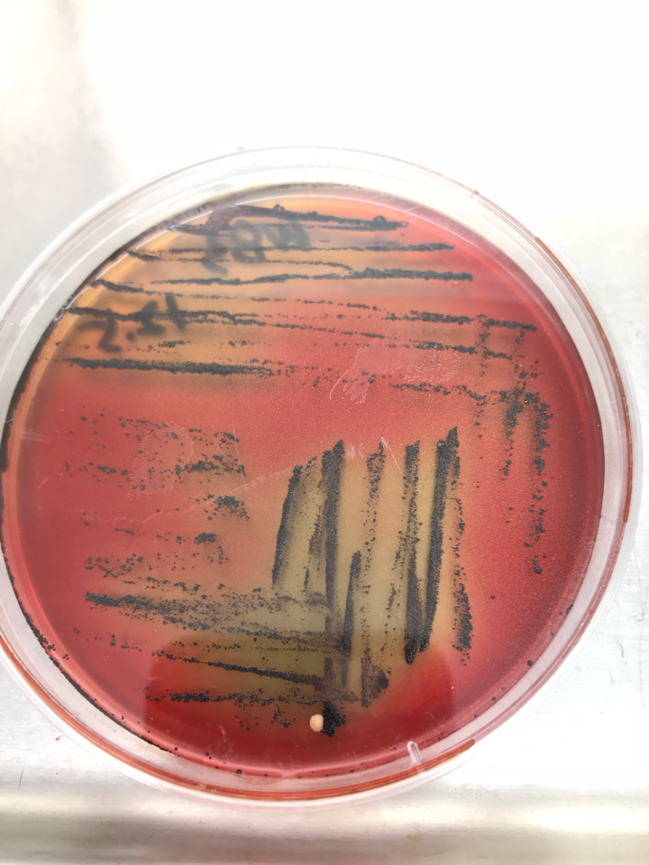 牙龈卟啉单胞菌的培养基? - 知乎