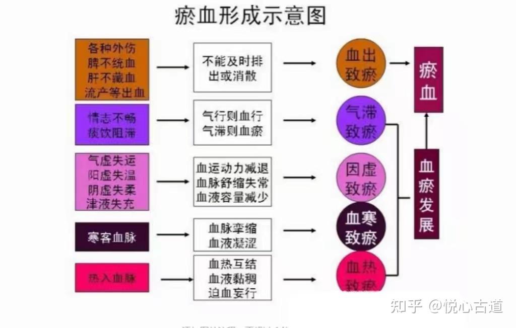 罗大伦：瘀血的识别与调理方法 - 知乎
