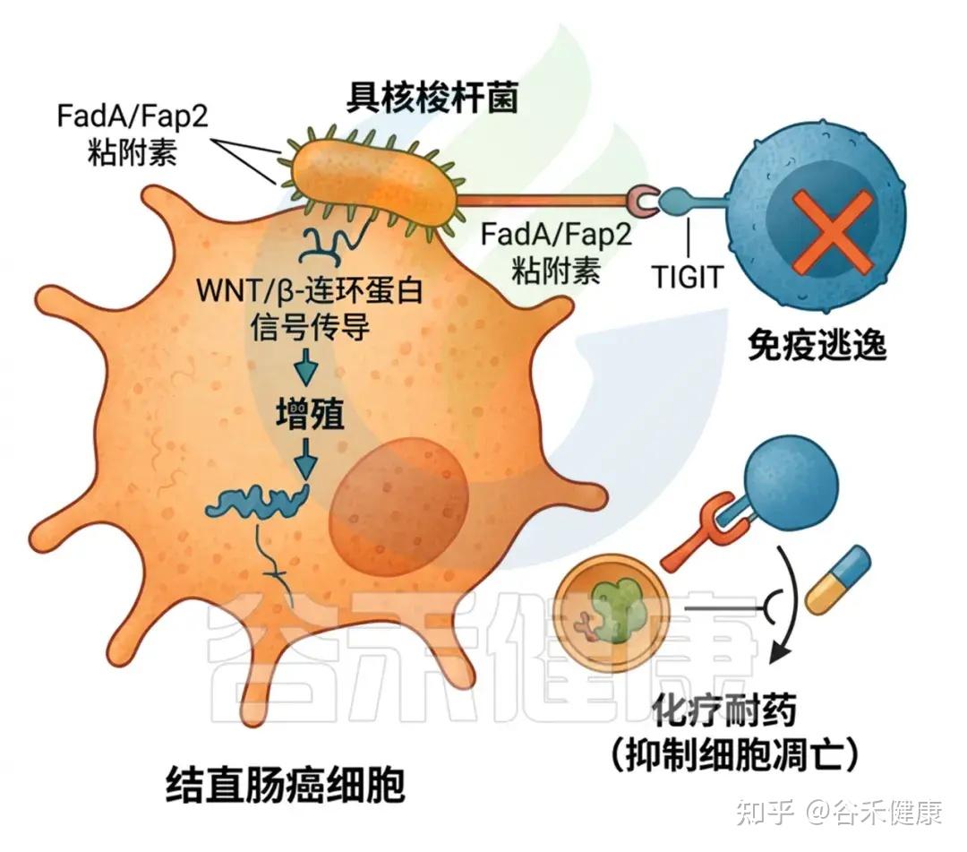 口腔微生物组指南（下）：菌群失衡与龋齿、牙周炎，及全身疾病风险与