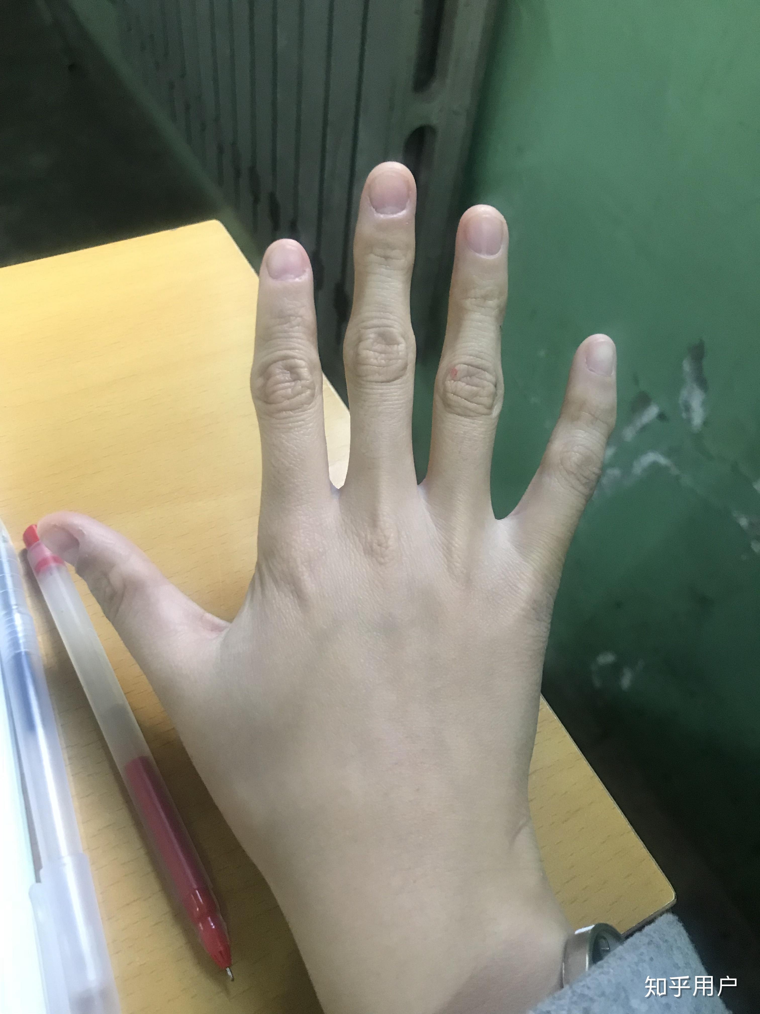 手长得难看是一种怎样的体验