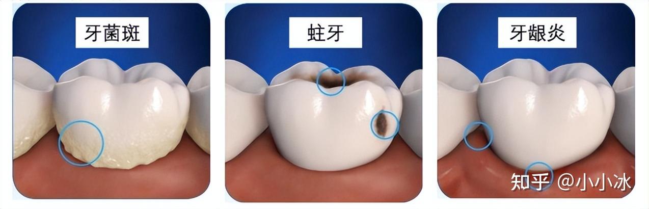 电动牙刷推荐_电动助力车价格及图片_电动牙刷测评