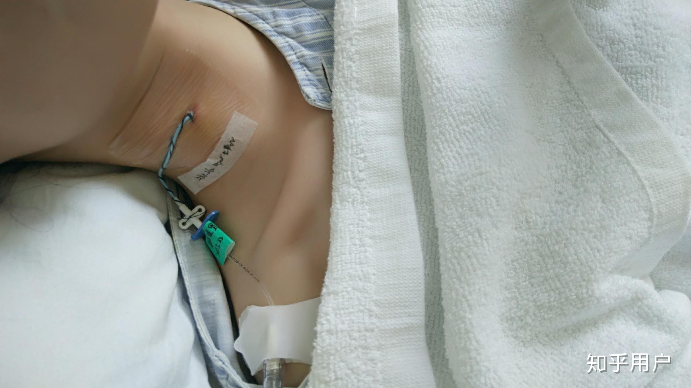 女朋友生病做手术住院,男朋友辞职去旅游,你怎么看? - 知乎