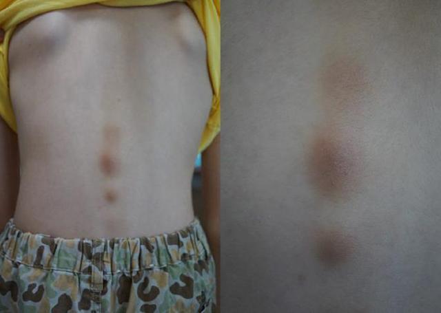 孩子皮肤变黑了?这个原因你可能想不到