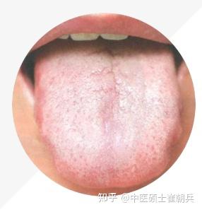史上最全舌诊图谱！【珍藏版】 - 知乎