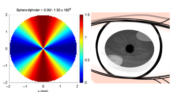那么散光会造成哪些影响呢？ - 知乎