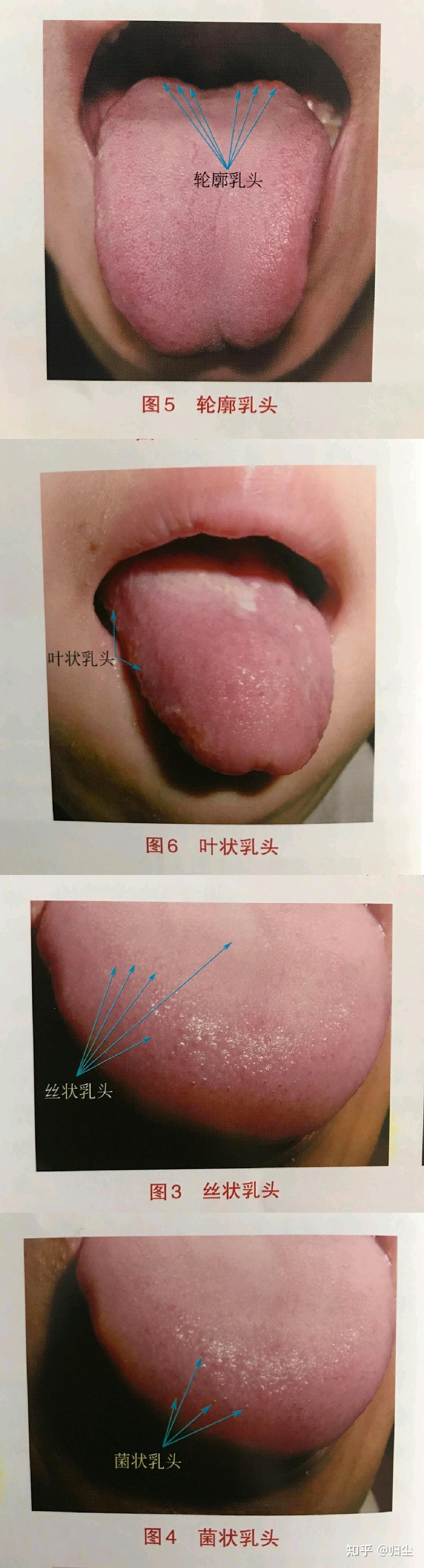 舌头根部? - 知乎