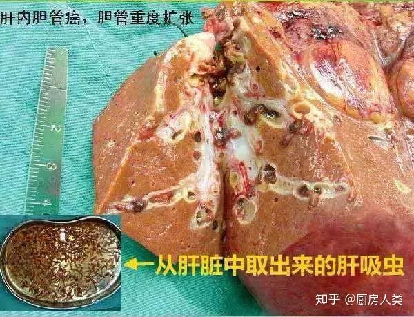 《风味人间》里的顺德鱼生是淡水生鱼片,不担心有寄生虫吗? - 知乎