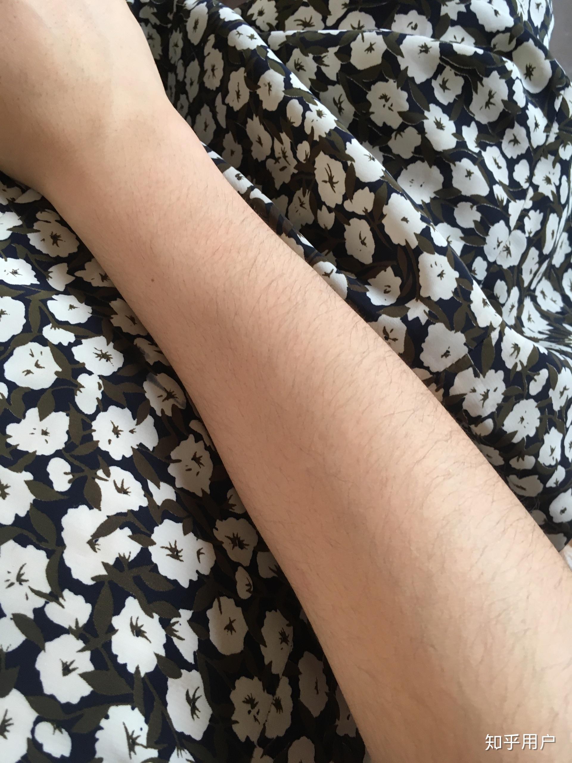 女生长浓密手毛是一种什么样的体验