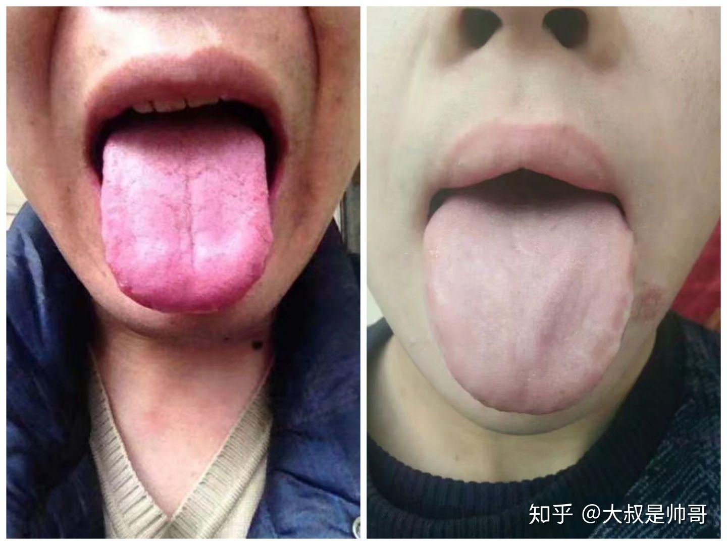 手淫过度是肾阴虚还是肾阳虚? - 知乎