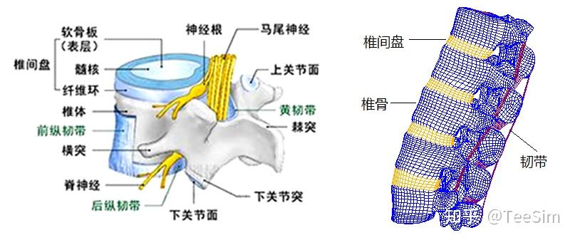 脊柱力学有限元仿真模拟腰椎间盘突出- 知乎