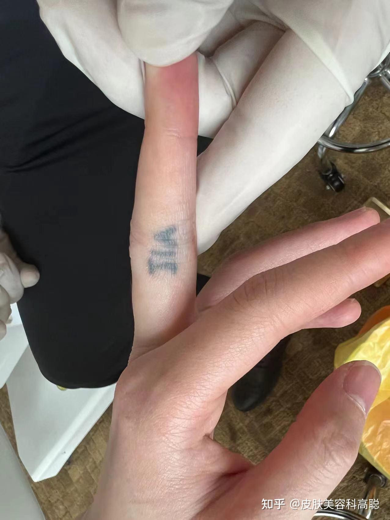 这个纹身晕色了怎么补救?还没有上色?求大神告知啊!给点方案? - 知乎