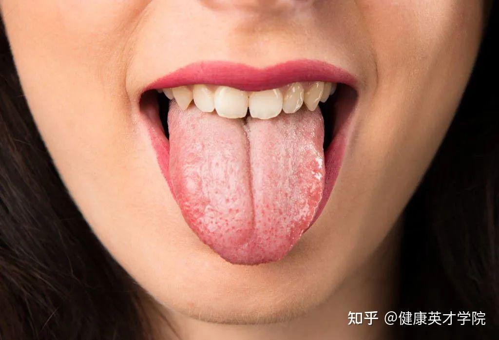 怎么通过看舌头，就知道体内湿气重不重？ - 知乎