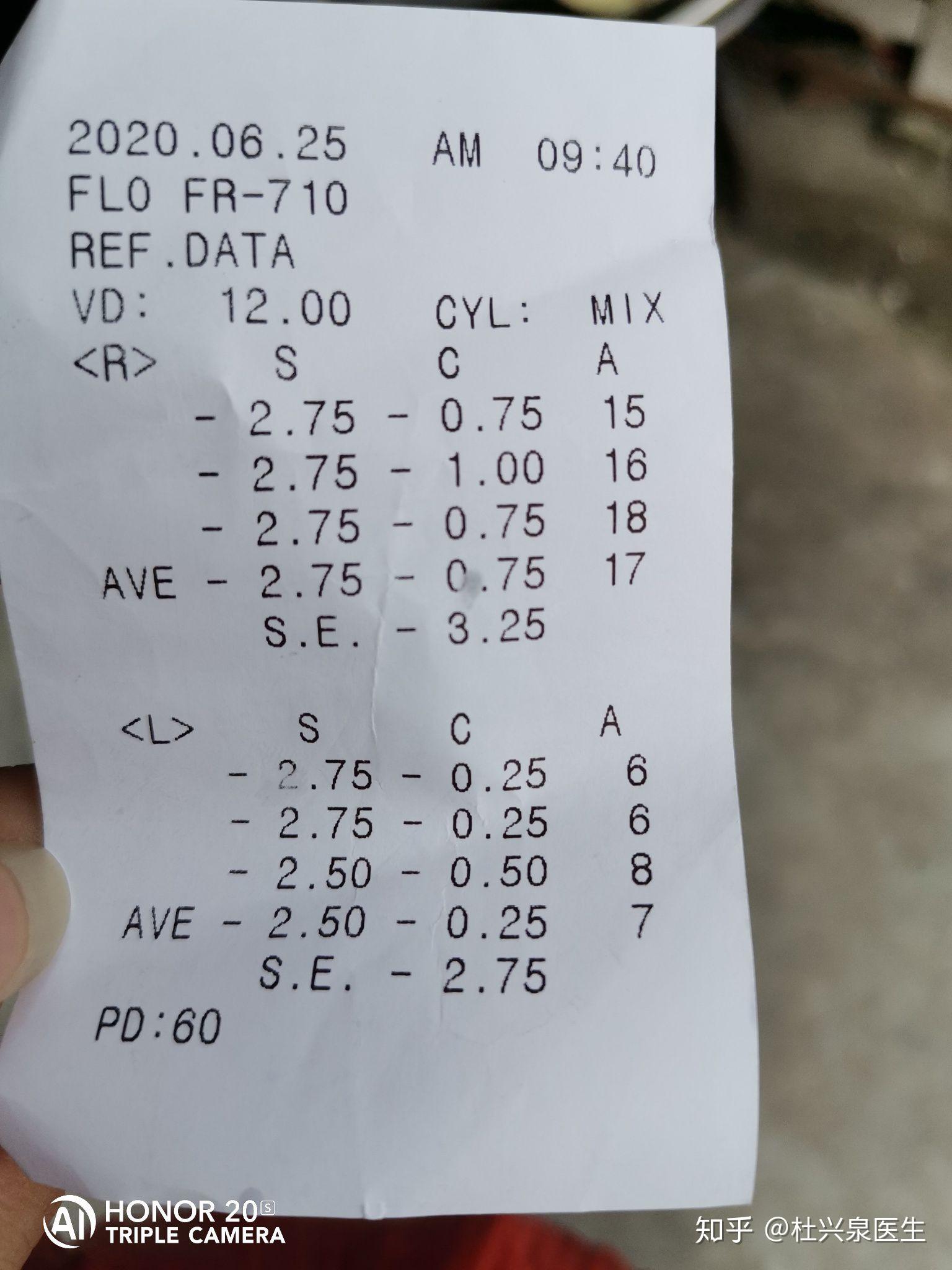 眼科验光单怎么看，眼科验光单怎么看度数