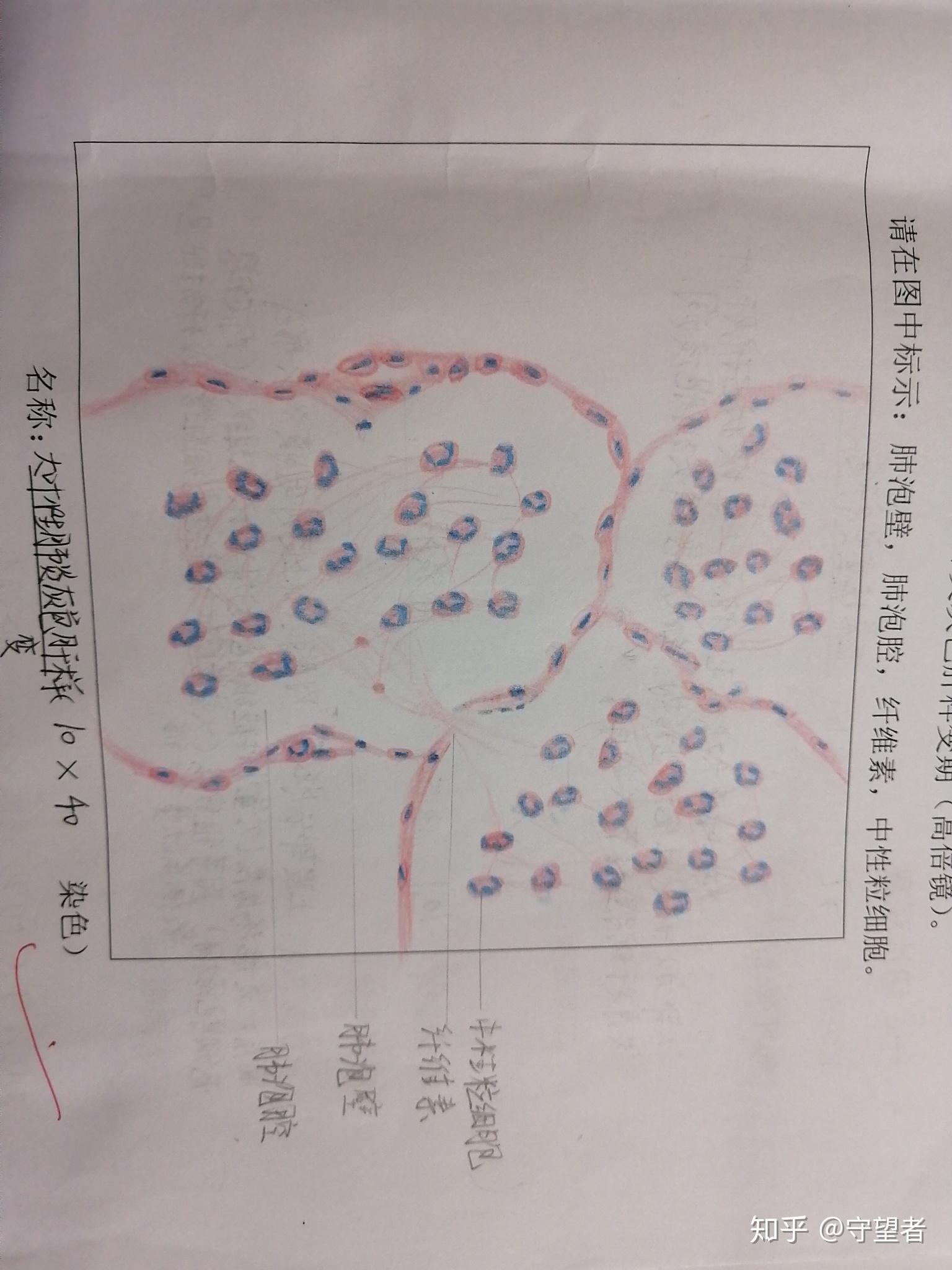 肺泡红蓝铅笔图片