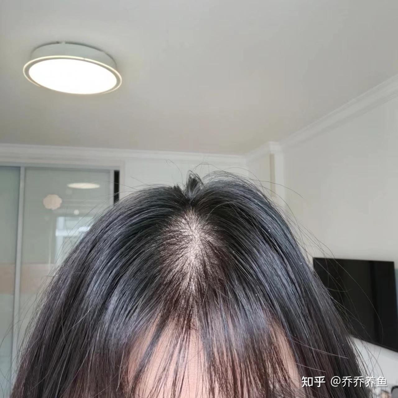 v2-9d0e74f1d04ae75157bd51d9ad79f8b6_r.jpg