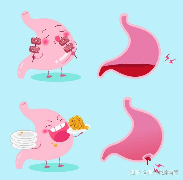 半夜反酸怎么办？如何从医学角度解释：胃酸反流的原因? - 知乎