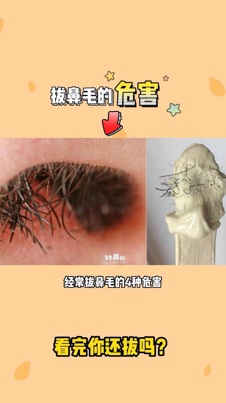 拔鼻毛的危害图片