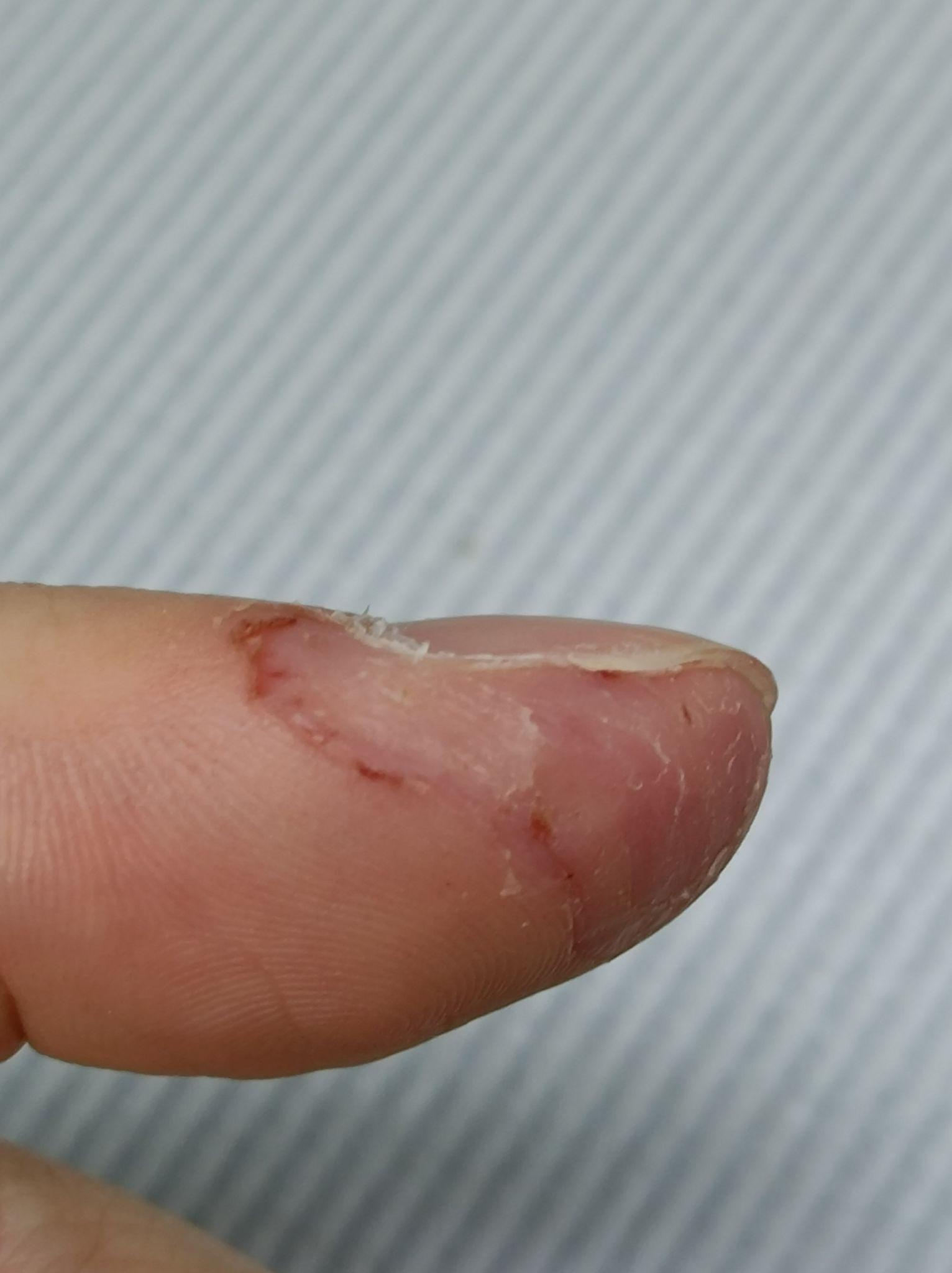 有喜欢抠指甲旁边的皮的吗? - 知乎