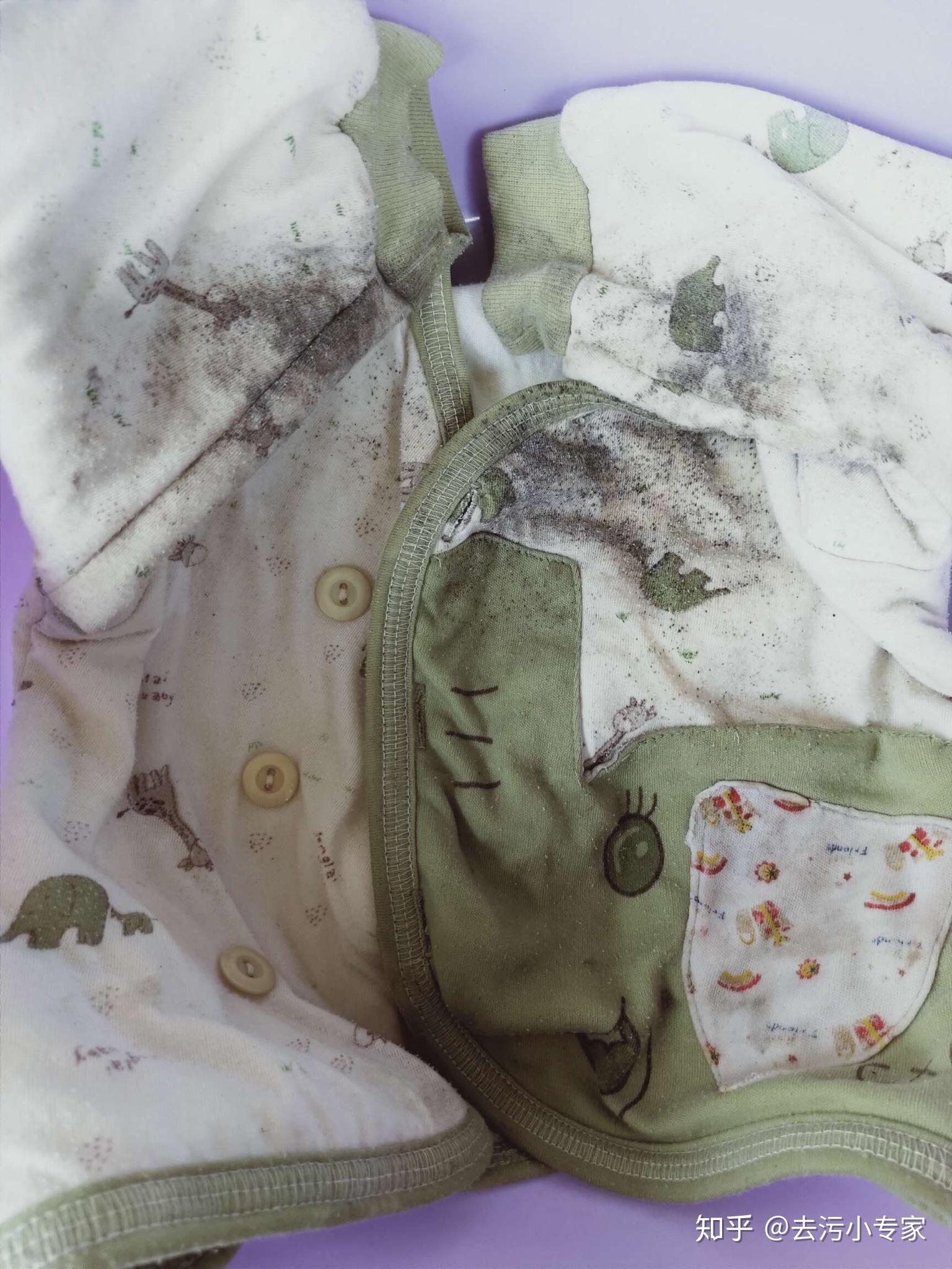 衣服上的霉菌会洗掉吗? 