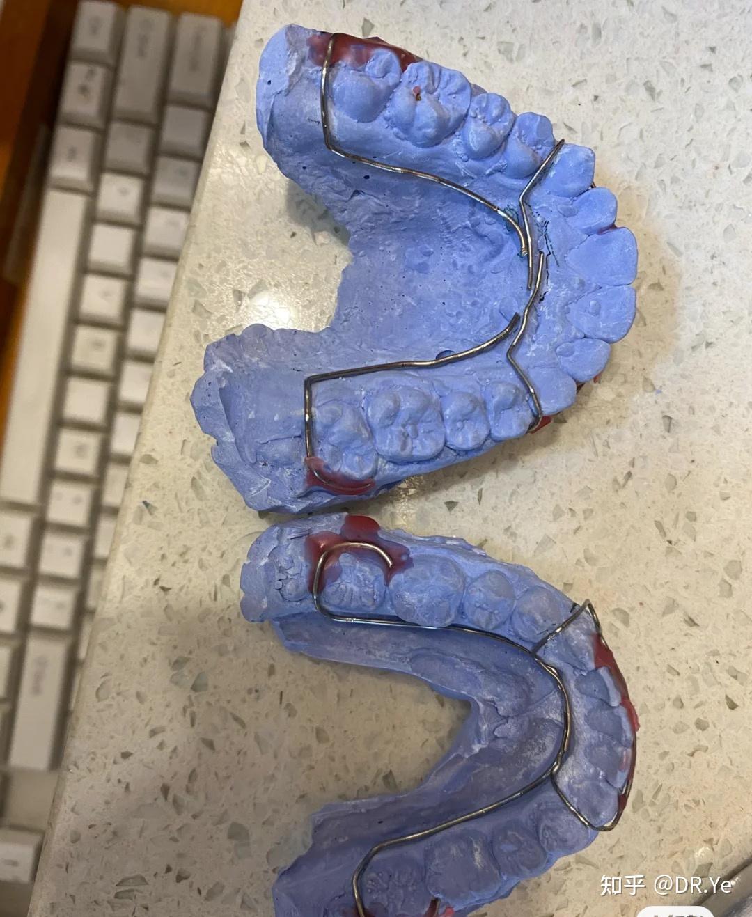 哈雷和透明保持器功能上可以替换吗?如果可以,想只带哈雷. - 知乎