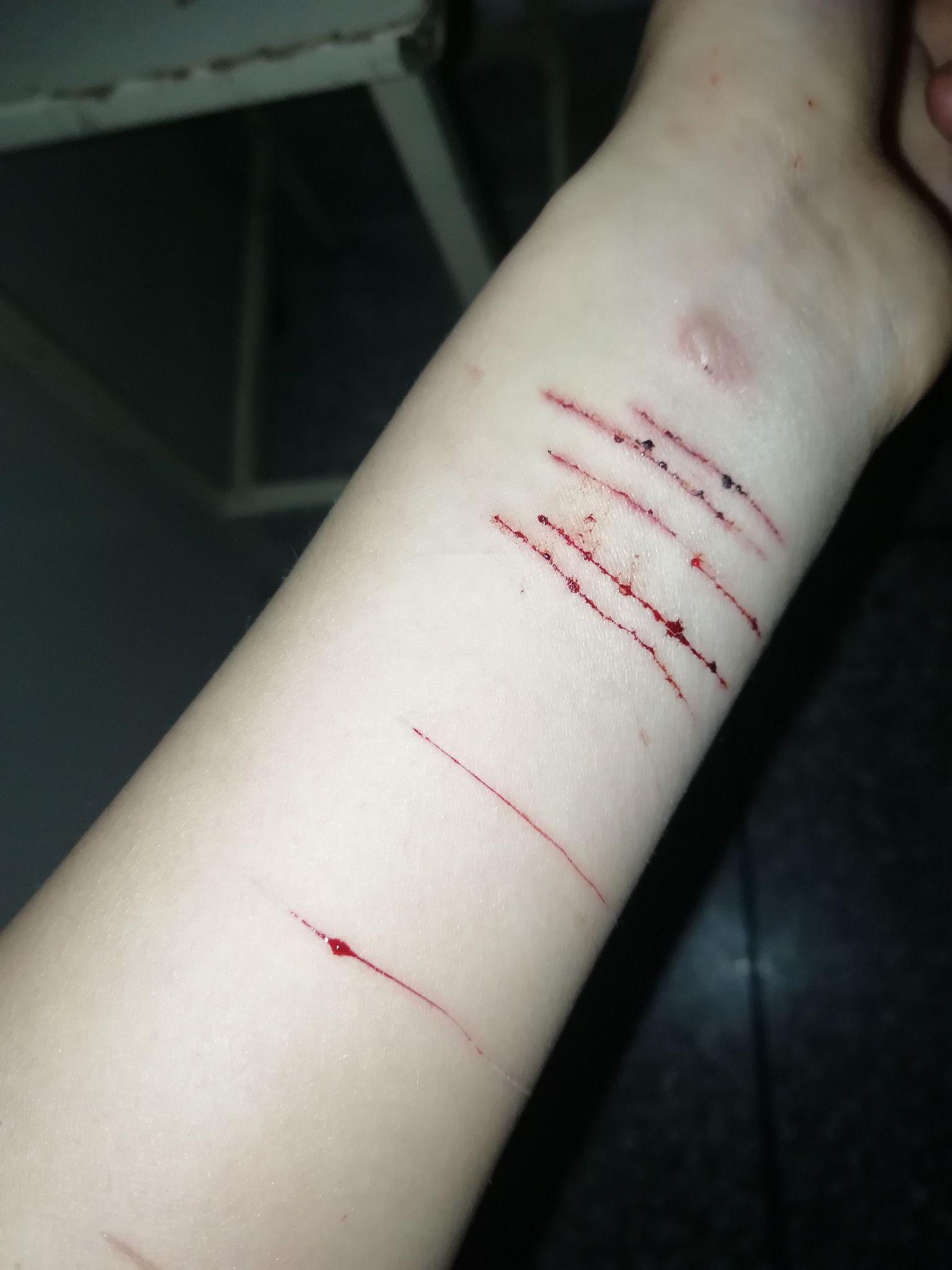 自残属于什么心理?