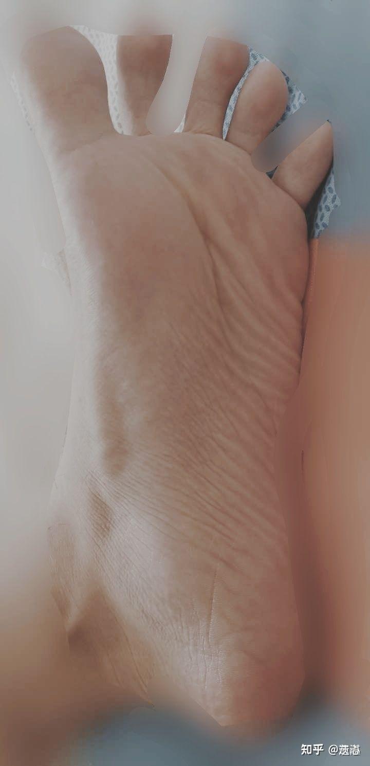 男孩子的脚底很嫩怎么样? - 知乎