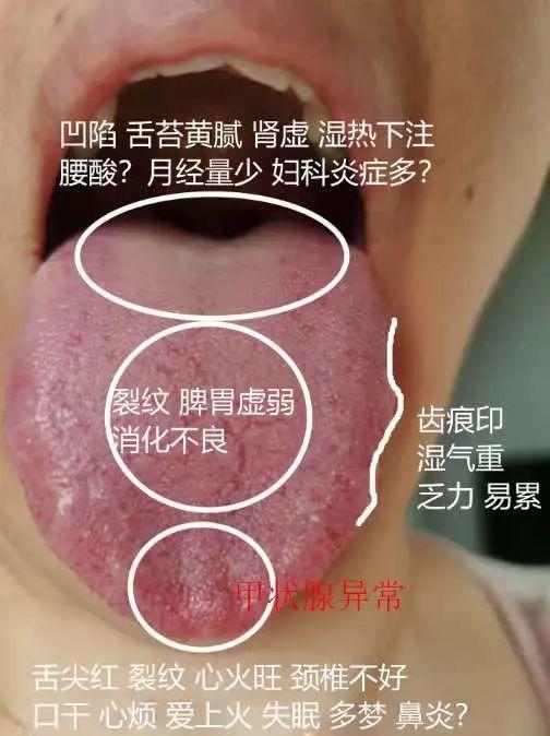 常见舌象分析 - 知乎