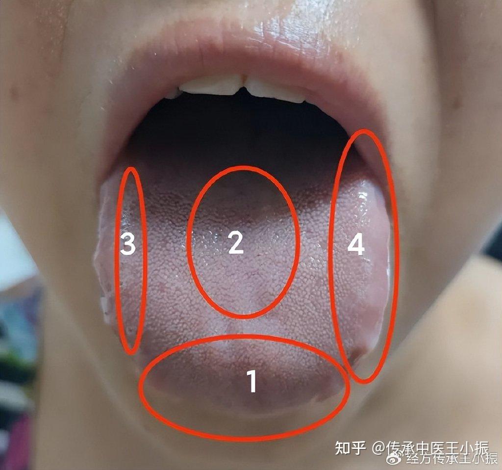 2分钟学会中医舌诊技巧，看病不求人，赶快收藏！ - 知乎